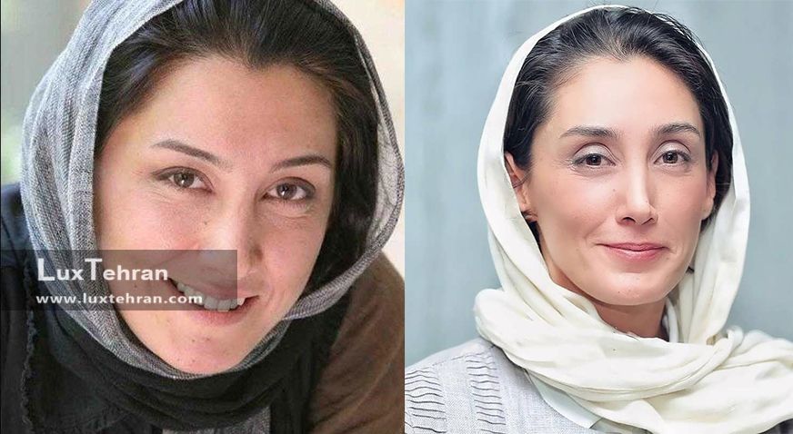صورت مهربان و بدون آرایش هدیه تهرانی